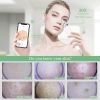 WiFi Visible Facial PoreCleanser with HD Camera Pimple AcneComedone Extractor Kit with 6 Suction HeadsElectric Blackhead Suction